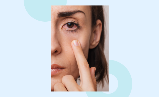 Contact lenses and allergies? Contact lenses and allergies?